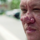 Illustration for article titled Dr. Pimple Popper Removes 68 Lipomas from One Person in Season 2 Premiere